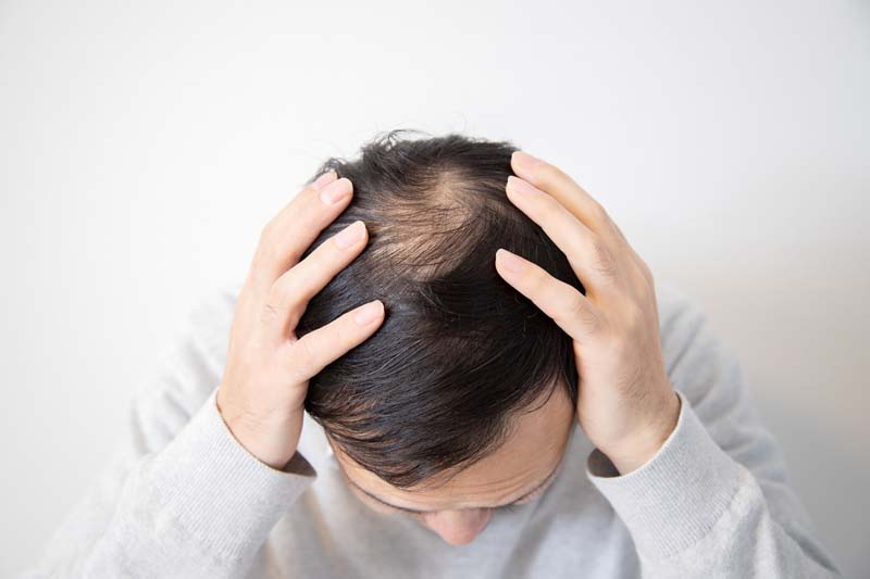 薄毛に悩む男性