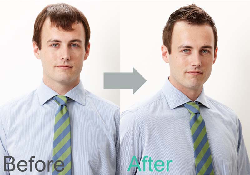 薄毛専門美容室でヘアカットをした男性のビフォーアフター