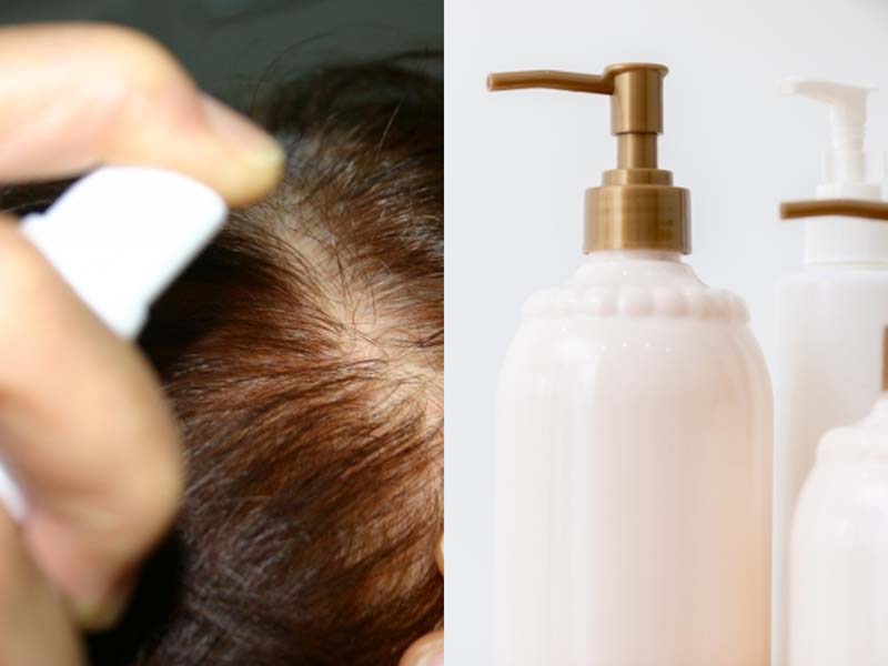 育毛剤と薄毛対策シャンプーのイメージ画像