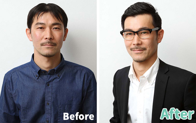 薄毛専門美容室スヴェンソンによる、ビフォーアフター写真