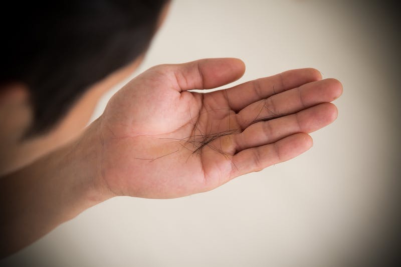 手のひらに乗せた複数の抜け毛を見下ろす男性