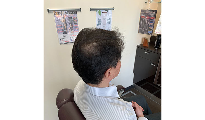 施術モデル　右後ろ