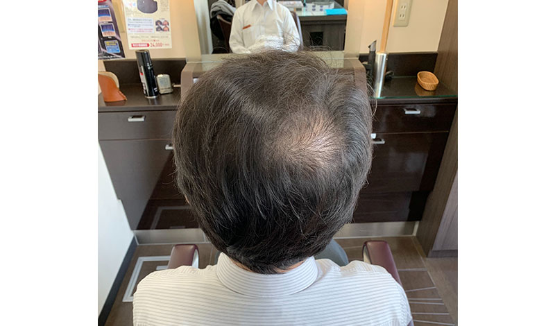 施術モデル　真後ろ