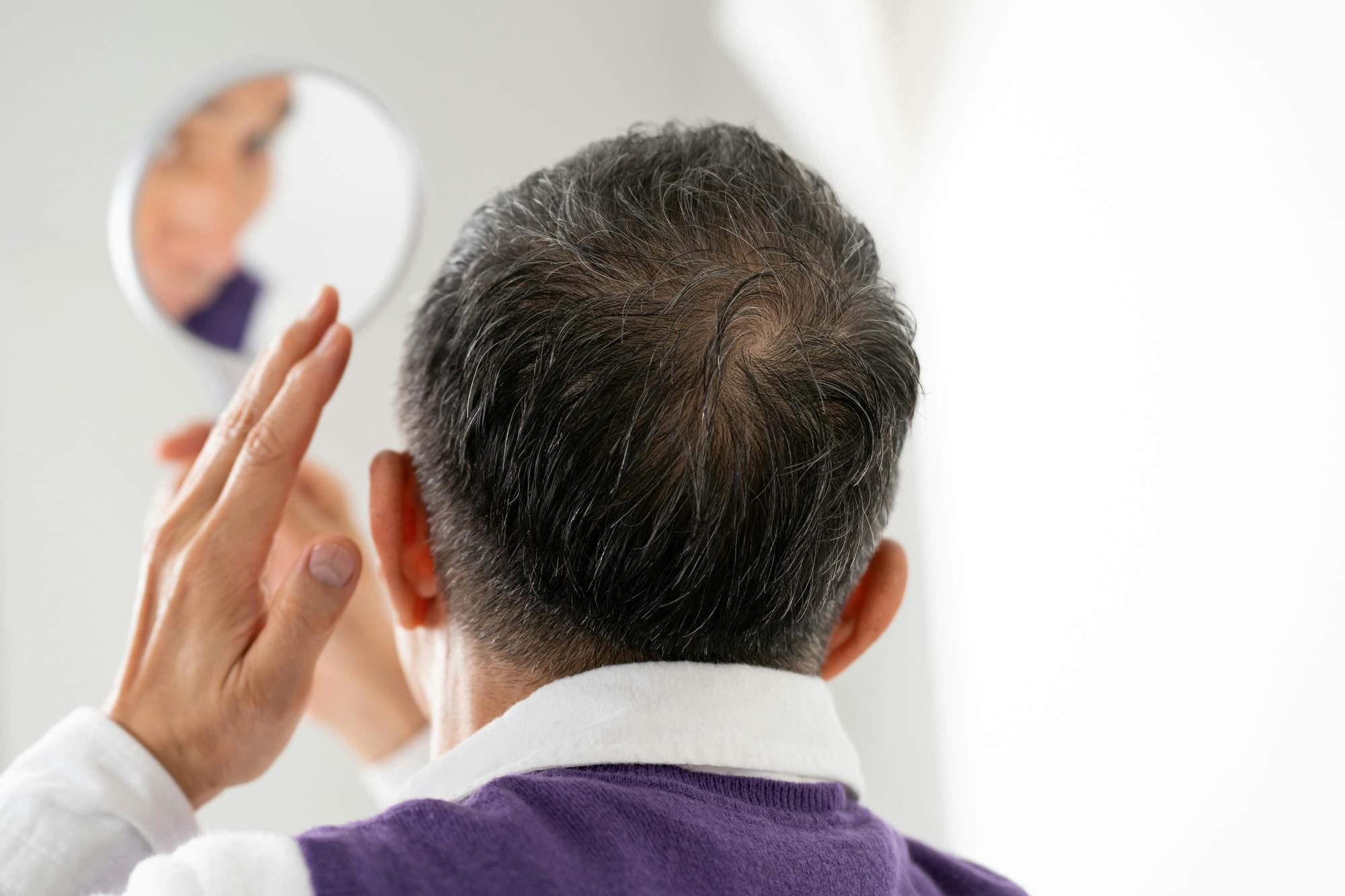 つむじ割れ 原因 01