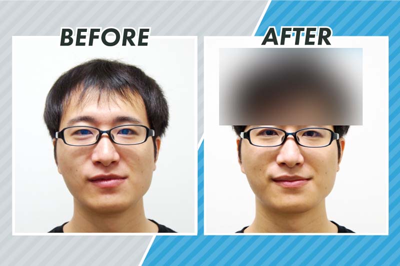 増髪前のコクブさんの正面写真