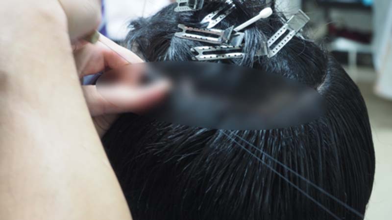 実際にスヴェンソンの編み込み式増髪をしている後頭部の写真（独自技術のため、編み込みの部分はモザイク加工）