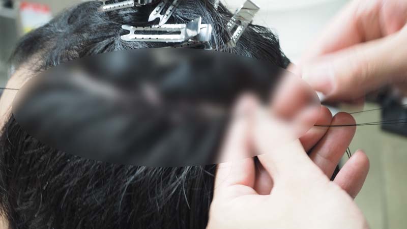 実際に編み込みをしている頭部の写真（編み込み部分は特殊技術のため、モザイク）