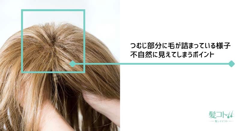 つむじ部分に毛が詰まっているカツラが不自然に見えることを説明する画像