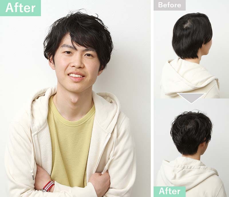 薄毛が目立たないカジュアルなパーマスタイルにセットした実例