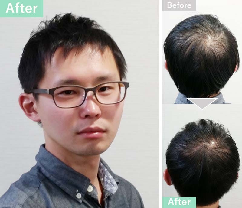 薄毛が目立たないツーブロックのショートヘアにセットした実例