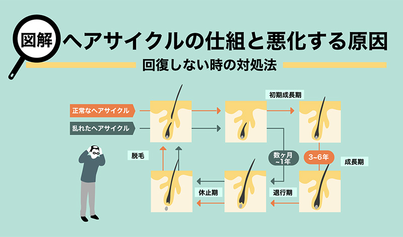 【図解】ヘアサイクルの仕組みと悪化する理由~回復しないときの対処法