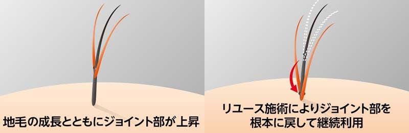スヴェンソンの結毛式（エクステ）増髪「マイヘアプラス」の毛材リユースの仕組みを説明したイラスト画像