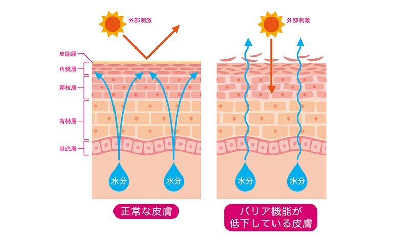 紫外線が頭皮に及ぼす影響を表したイラスト