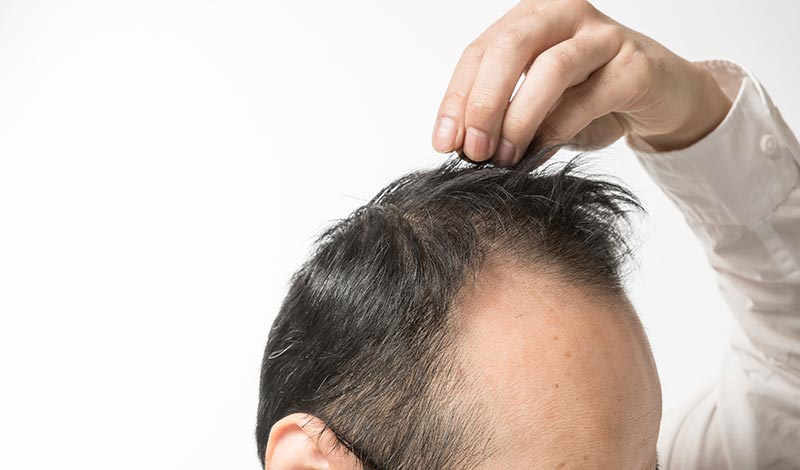 薄くなった髪の毛を触る