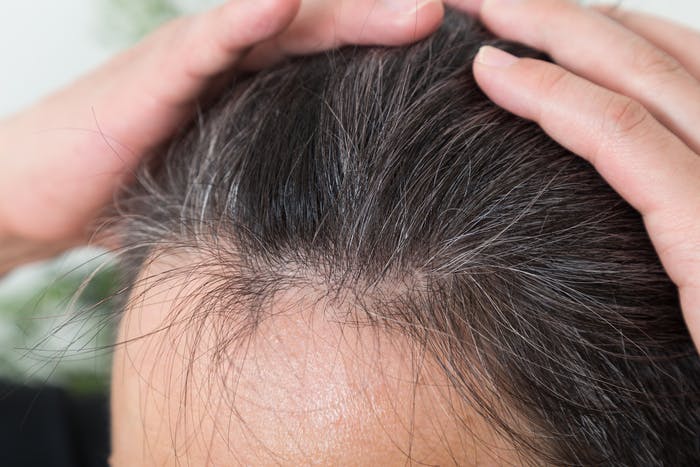 髪をかき上げて毛髪の様子をチェックしている人
