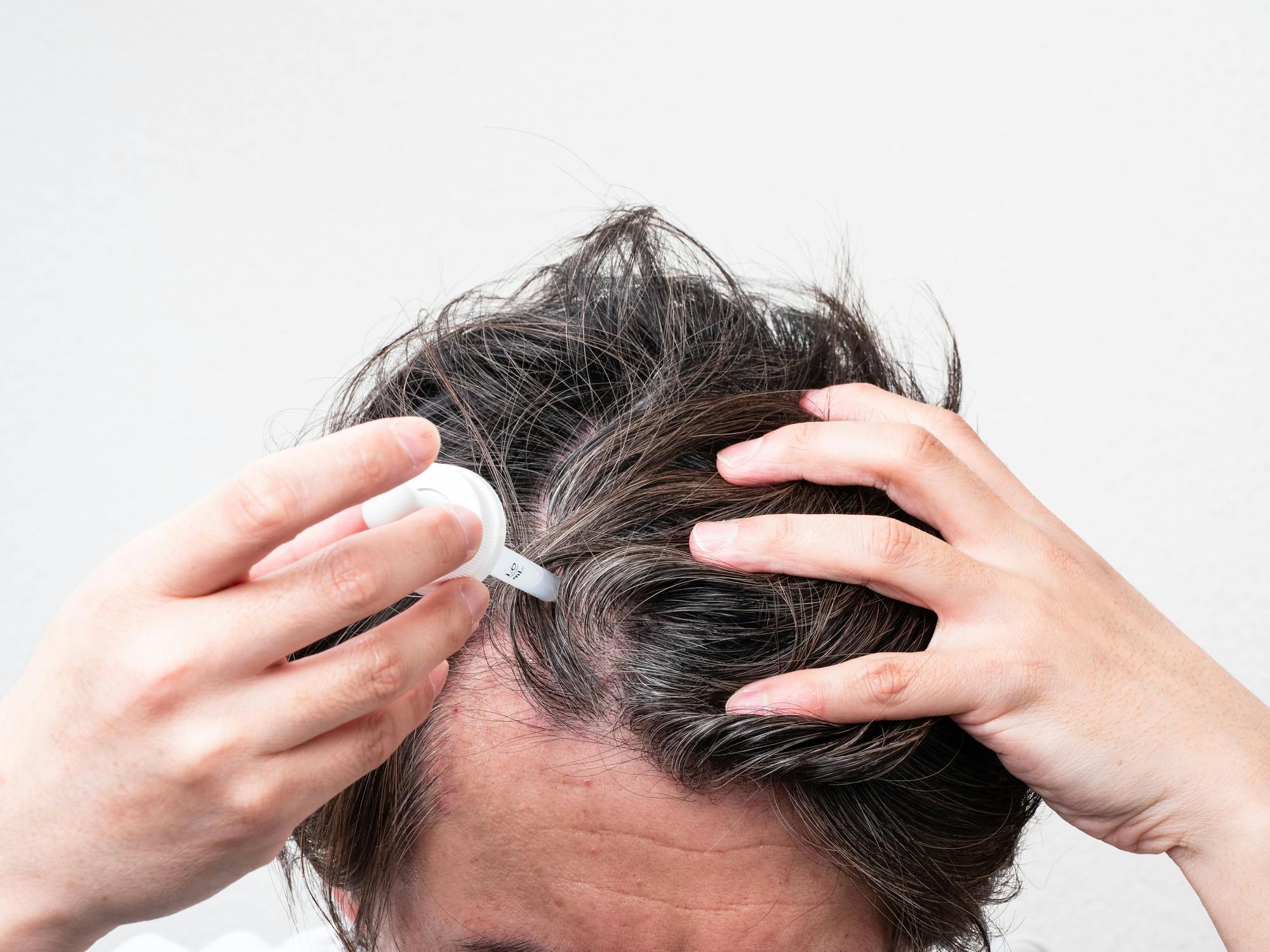 髪が薄くなった前頭部に育毛剤を付ける男性