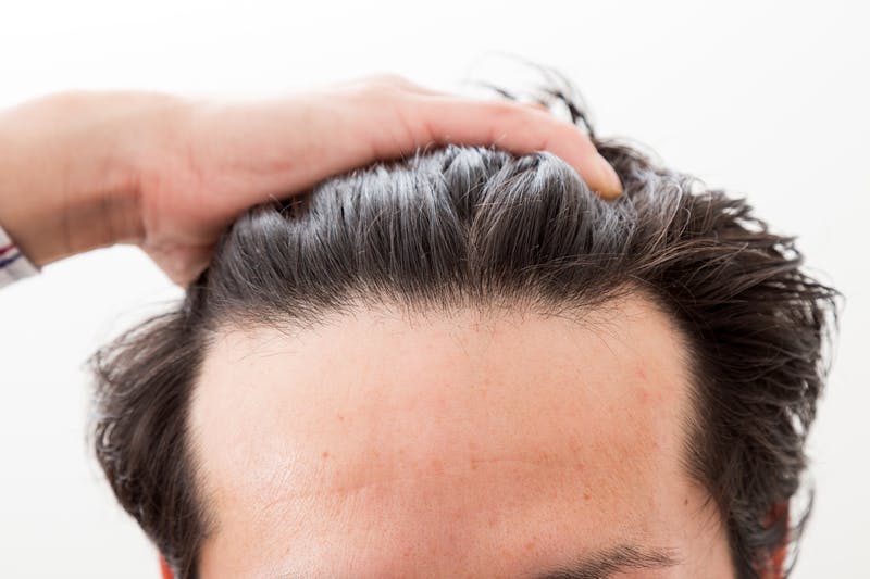 髪をかき上げ額を露出させる男性