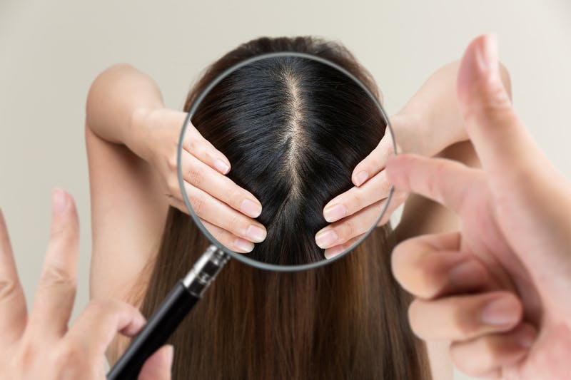 両手で分け目を広げた若い女性の頭部をルーペで観察