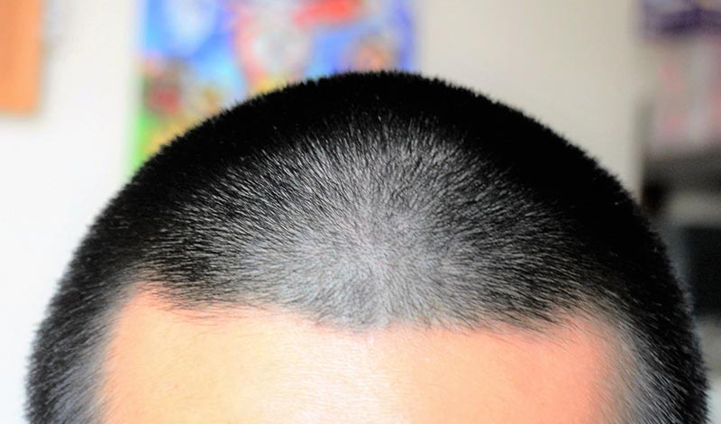 日本人の坊主頭