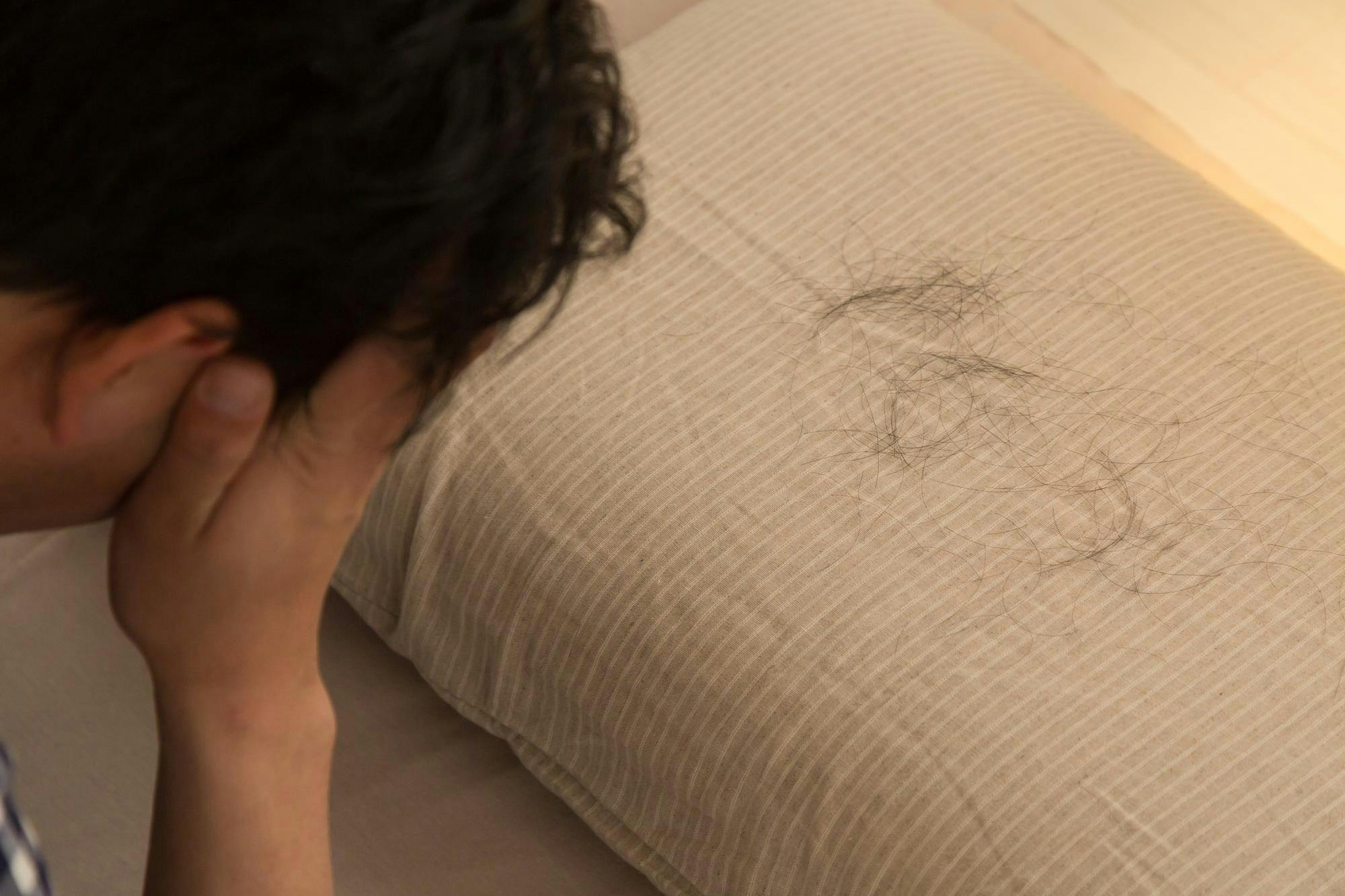 枕に付着した大量の抜け毛を前に頭を抱える男性
