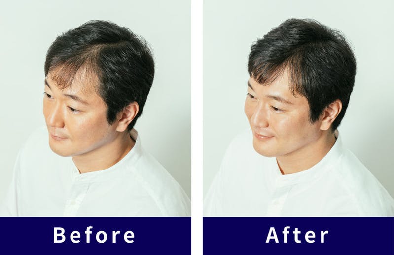 Before After