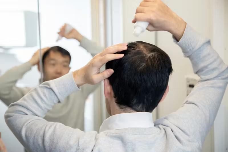 三面鏡を前に育毛剤を使う男性