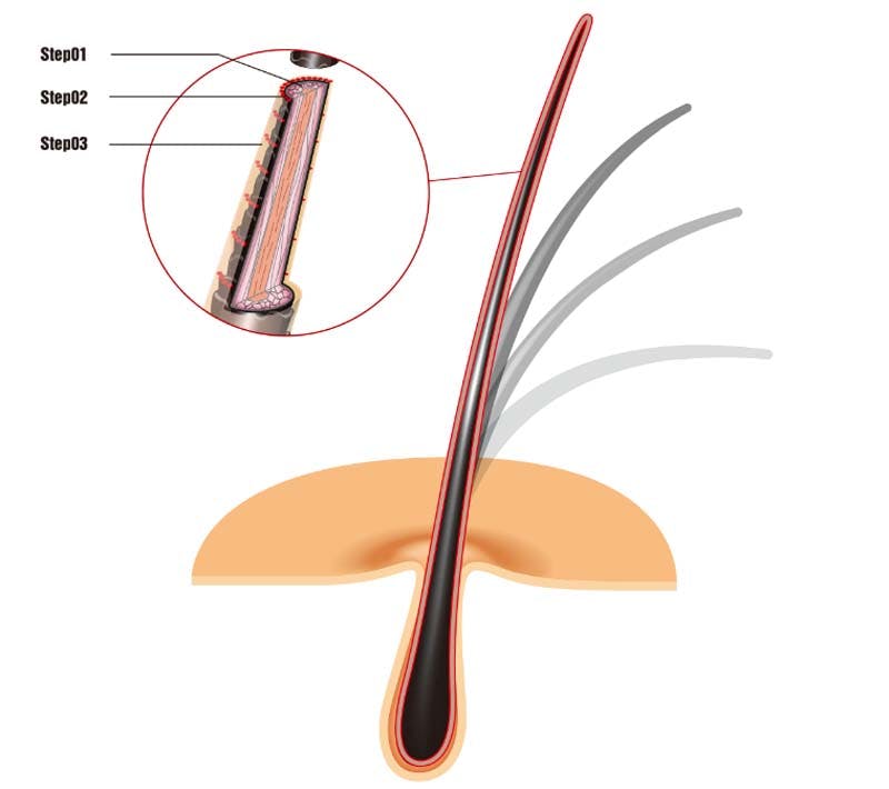 スヴェンソンの「ヘアライズ®」