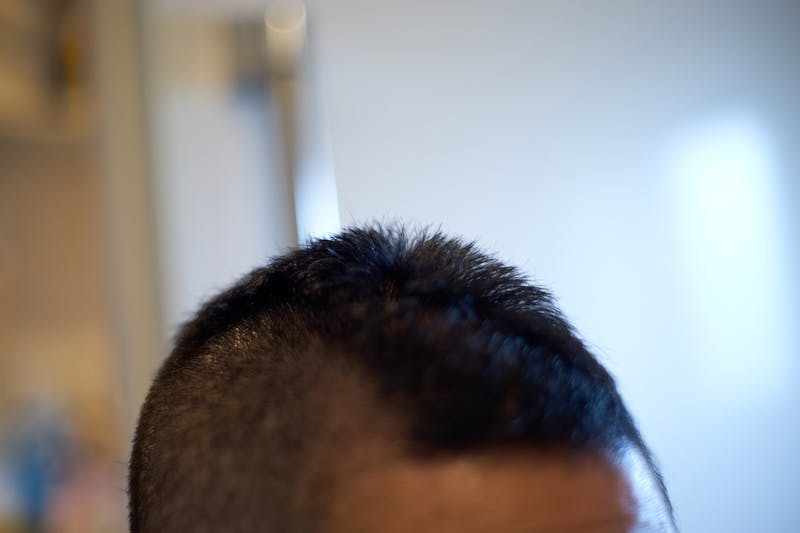 側頭部を頭頂部にかかるまで大胆に刈り上げた男性の頭部