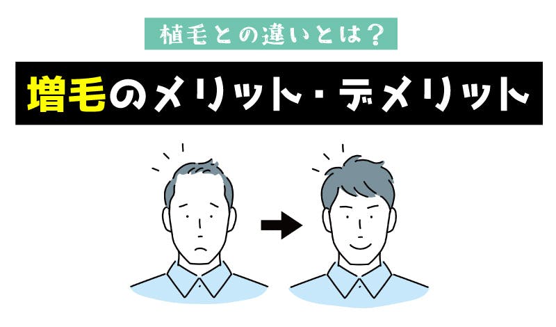 増髪の方法って何がある?メリットやデメリットを徹底解説