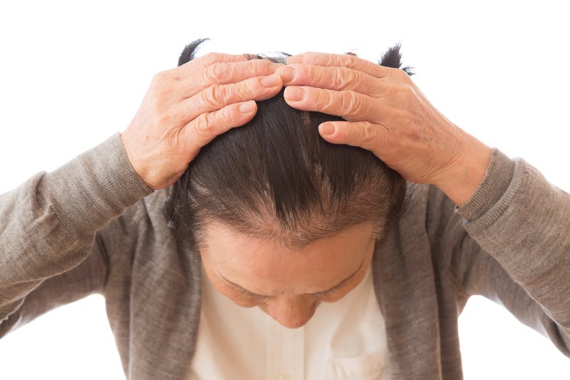 髪を両手でかき上げたシニアの頭部の見下ろし