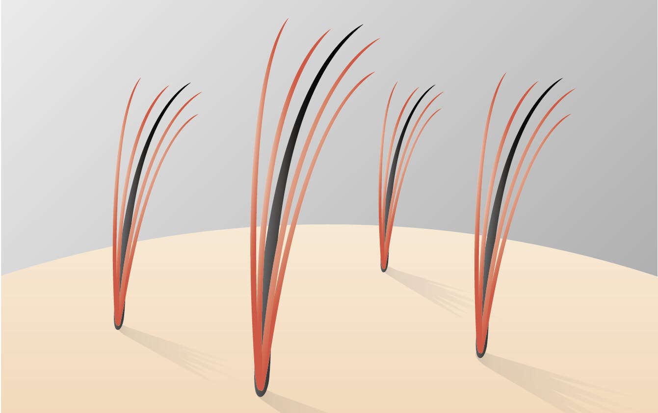 自分の髪を活かせる増髪法とは!?