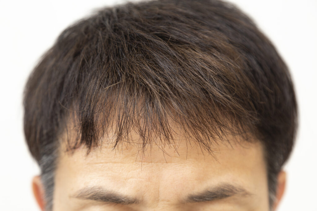前髪を下ろした男性のヘアスタイル写真
