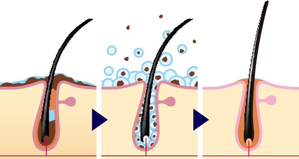 スカルプクレンジング