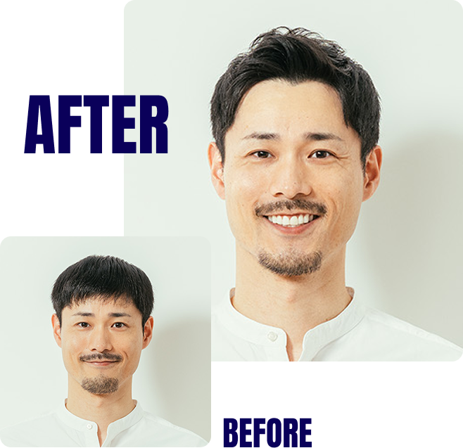 ヘアライズ®　before after