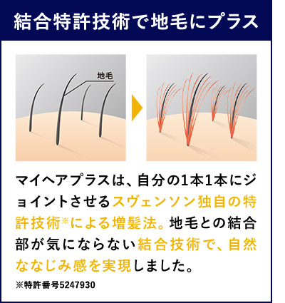 結合特許技術で地毛にプラス 地毛 マイヘアプラスは、自分の1本1本にジョイントさせるスヴェンソン独自の特許技術※による増髪法。地毛との結合部が気にならない結合技術で、自然ななじみ感を実現しました。 ※特許番号5247930