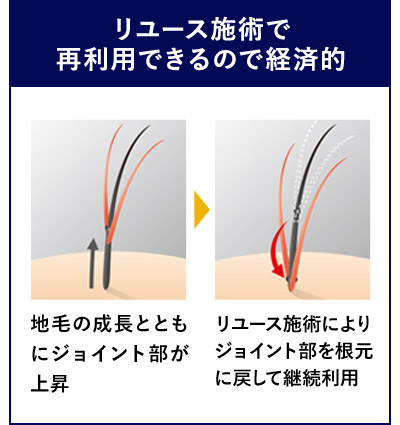 リユース施術で再利用できるので経済的 地毛の成長とともにジョイント部が上昇 リユース施術によりジョイント部を根元に戻して継続利用