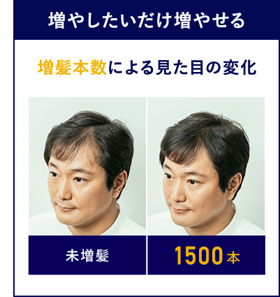 増やしたいだけ増やせる 増髪本数による見た目の変化 未増髪 3000本