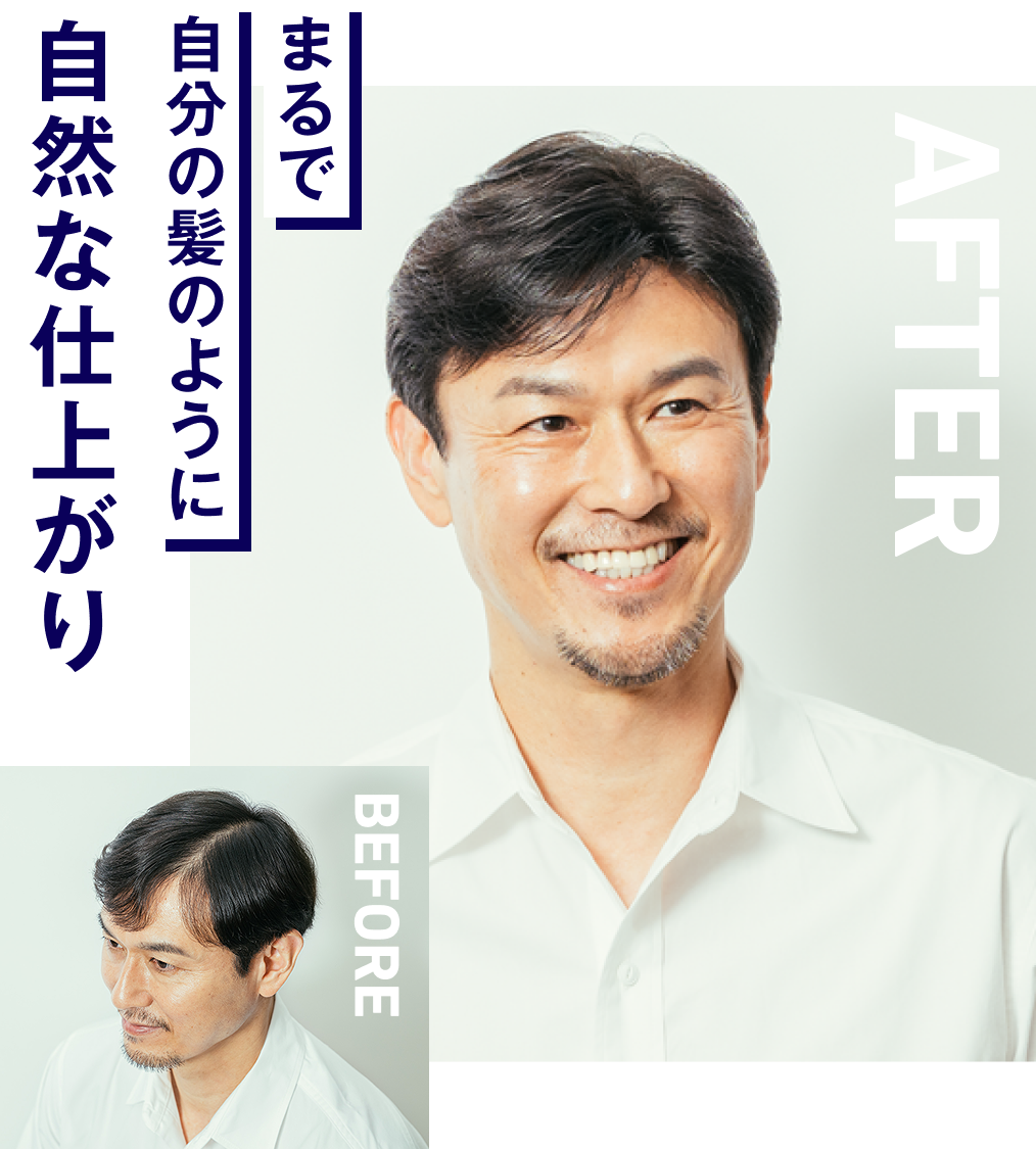 WIG CLUB ONLINE STORE｜スヴェンソンのオンライン完結型ウィッグ